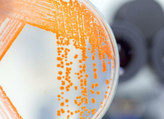 Serratie, rožnata sluz v kopalnici: Kako se je znebiti? Serratia marcescens je vzrok za nastanek rožnate sluzi v kopalnici