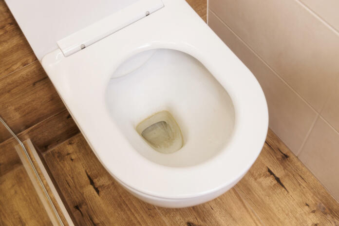 Close-up, top view, dirty unhygienic toilet bowl with lime yellow stain in the toilet. Modern apartment with a minimalist interior