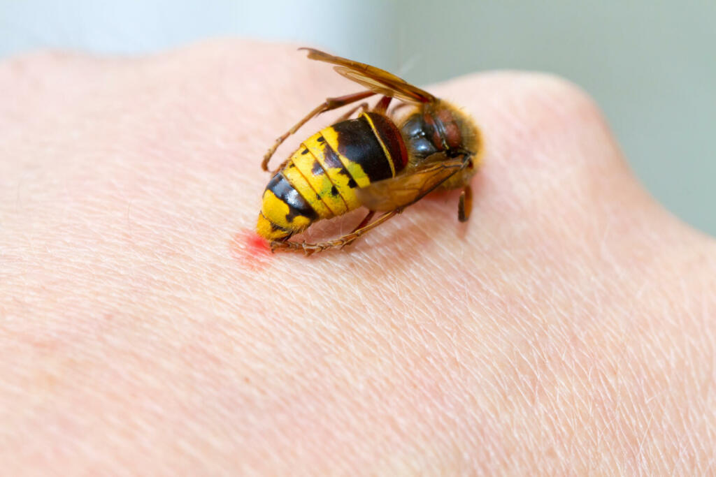 Hornet on a hand sting in the skin