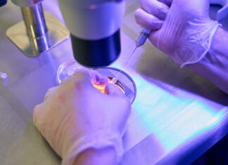 Znanstveniki: Odkrili smo manjkajoči člen. Zdaj vemo, kako vrsta hrvane vpliva na razvoj raka! Reproductology laboratory assistant adding special drops with capillary holder for retrieving spermatozoa before injection, ICSI procedure