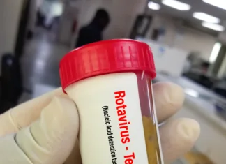 Prihodnost medicine je v vaših iztrebkih Biochemist hold feces sample for Rotavirus test to diagnose a rotavirus infection. Rotavirus antigen test. viral gastroenteritis.