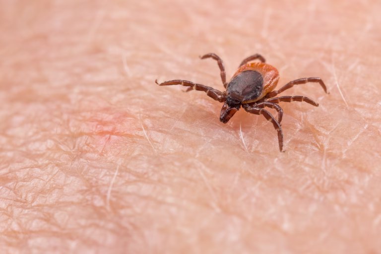 Closeup of insect mite on pink epidermis. Danger of tick-borne diseases transmission by infected parasite