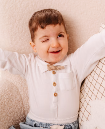 3-letni mali borec Jurij, ki ima hudo redko bolezen Rubinstein Taybi sindrom in je zaradi svoje bolezni ostla brez desnega očesa